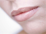 Dermal filler costs