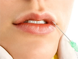 Dermal filler side effects