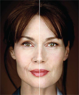 Should I have Dermal filler?